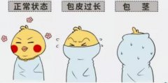 龟头很多白垢的原因？