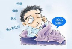 真菌龟头炎可以治愈吗？